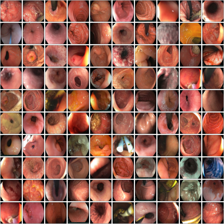 Sample Images from GastroNet-5M